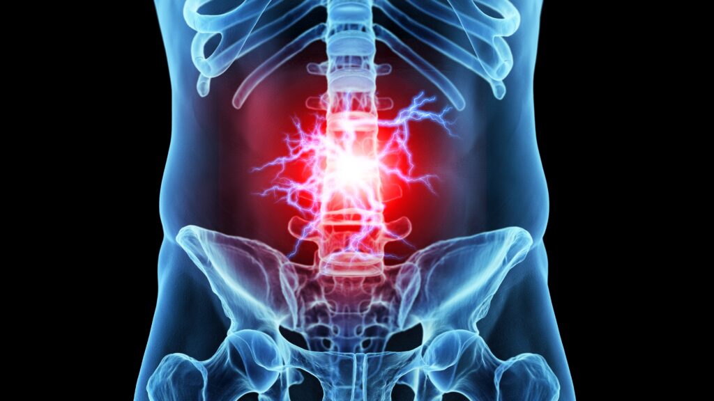 Symptômes du lumbago